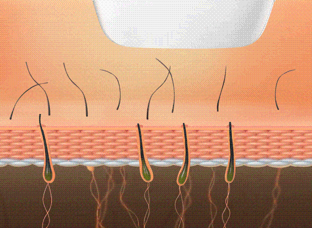 薇婷脱毛膏正确使用方法，薇婷脱毛膏正确使用方法图解（5款爆火脱毛产品真人实测）