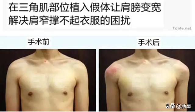 沈昌珉颜值巅峰，沈昌珉被韩网夸是“出道9年的鲜肉”