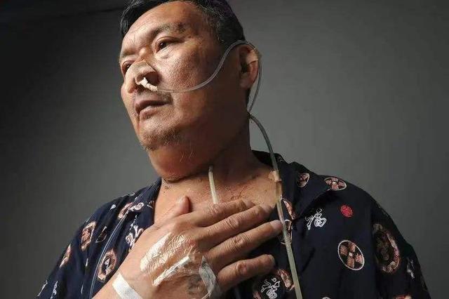 嚼槟榔为什么上瘾，吃槟榔为什么会上瘾（我国约有1亿人在嚼槟榔）