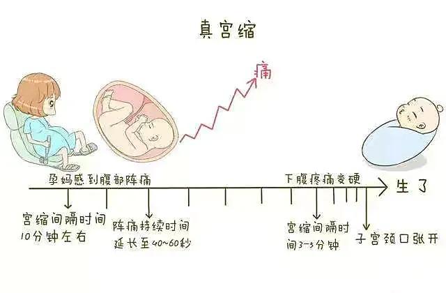 什么是假性宫缩，什么是假性宫缩什么是真性宫缩（“假宫缩”和“真宫缩”的区别是什么）