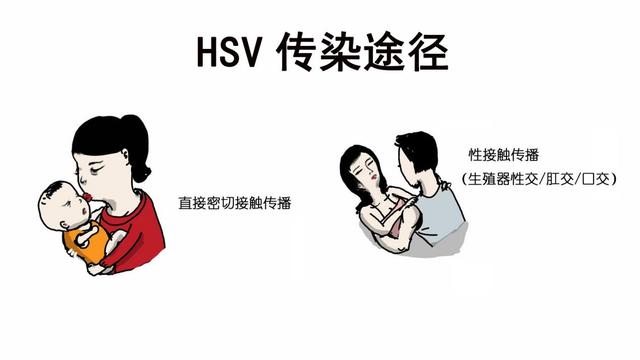 嘴巴上火起泡怎么办，嘴巴起泡怎么办（你以为的“上火”）