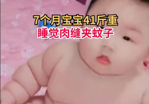 怎么确认自己是婴儿肥，婴儿肥是什么原因（网友：胖的跟莲藕样的）