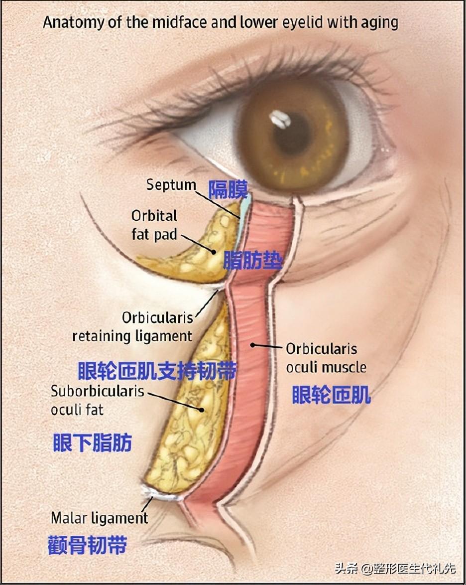 消除眼袋超简单方法(怎么让眼袋自然消除)