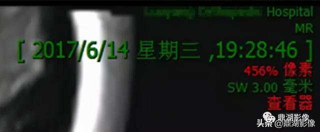 r和l哪个是左哪个是右，袜子r和l哪个是左哪个是右（竟然包含了这么多的信息）