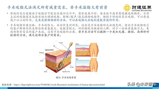 伊婉玻尿酸是韩国进口的玻尿酸吗，伊婉玻尿酸是哪个国家生产（从产品布局出发寻找下一个艾尔建）