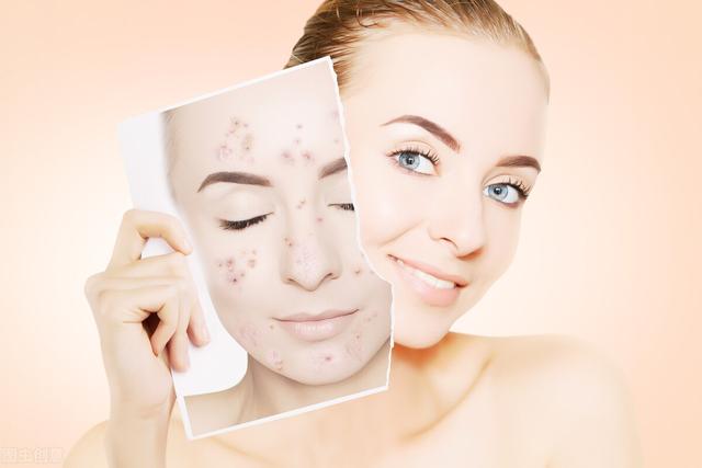 黑裤子发红怎么样能恢复黑色呢，黑色裤子发红怎么还原（为什么你一晒就黑）