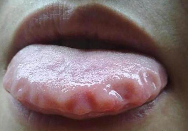 头发一天长多少，人的头发每天会长多长（31岁女士脱发十来年）