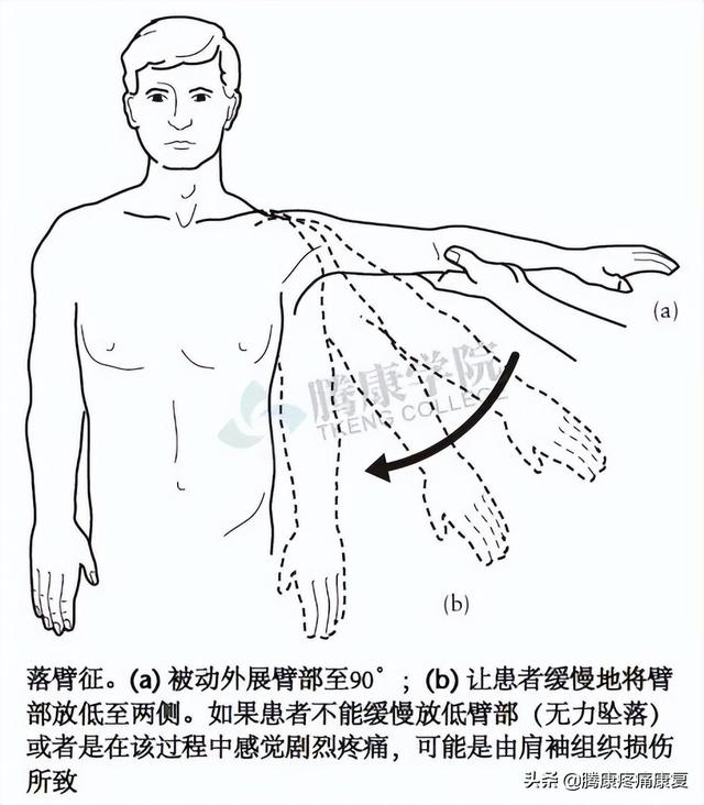 biceph，肩关节的特殊检查（bicep curl）