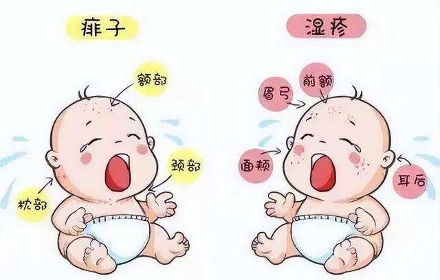 痱子和湿疹的图片对比，湿疹和痱子的对比照（让你轻松认识痱子和湿疹）