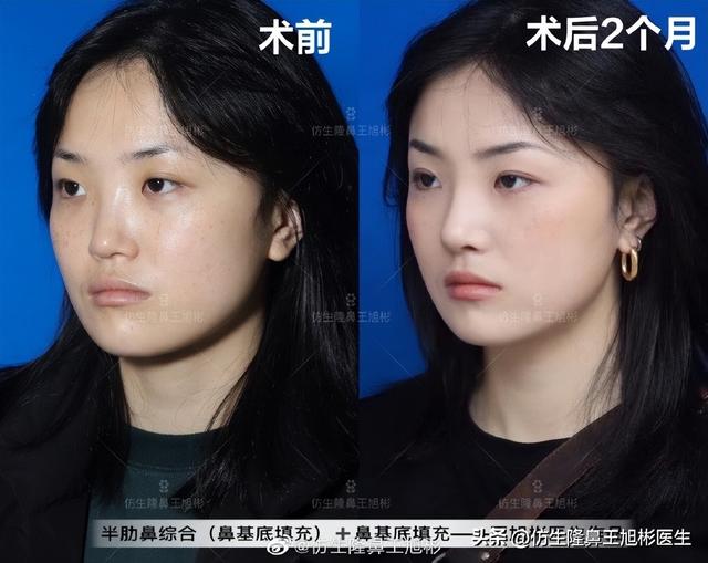 高级脸是什么意思，6种脸型不显老（“月亮脸”逆袭“高级脸”的不二法则是）