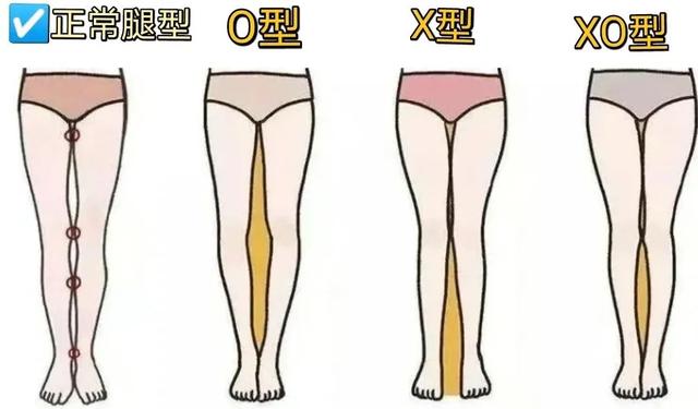 腿粗但肉特别硬怎么减，腿粗还硬怎么减肥（梨型身材、微胖、腿粗）