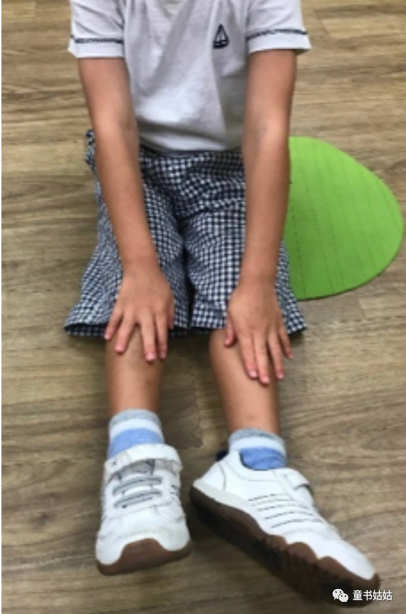 纠正儿童内八字的方法图解，宝宝走路内八字怎么办（快看看你家宝宝这样坐吗）