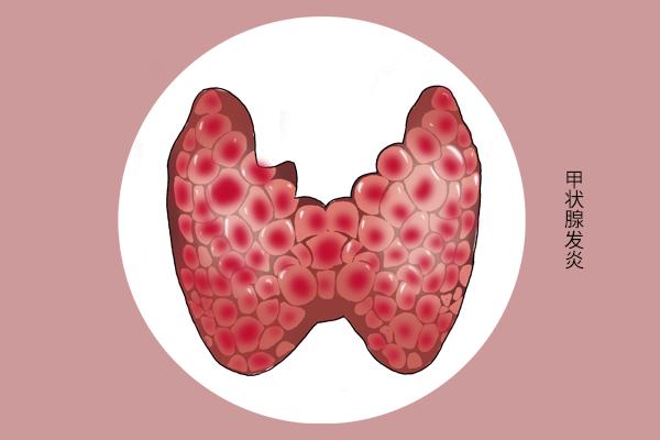 含硒的食物和水果有哪些，富硒大米多少钱一斤（5大富含硒元素的食物）
