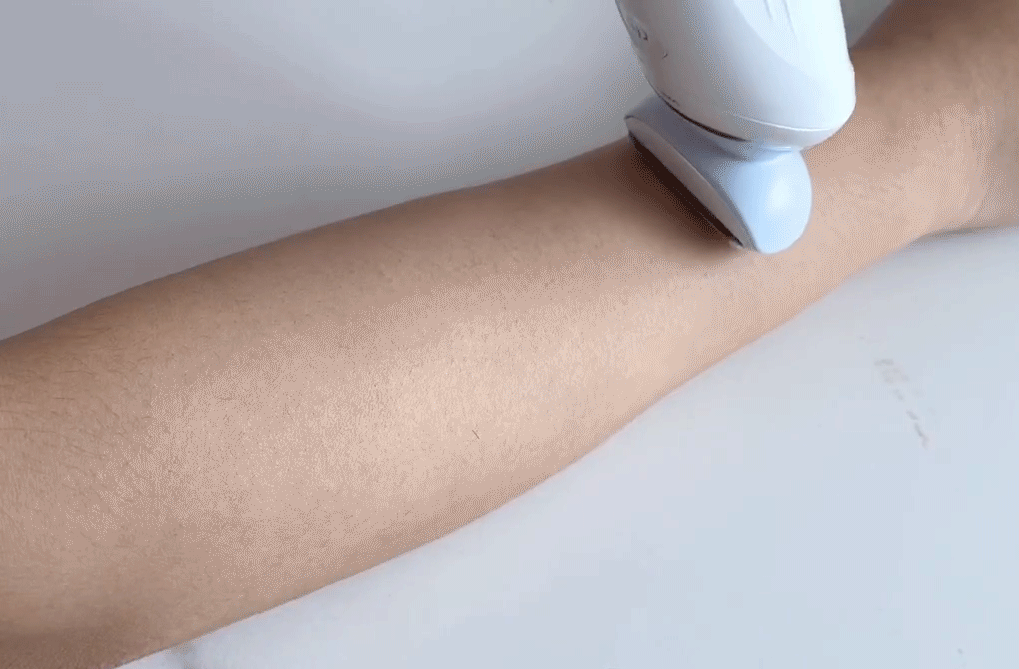 薇婷脱毛膏正确使用方法，薇婷脱毛膏正确使用方法图解（5款爆火脱毛产品真人实测）