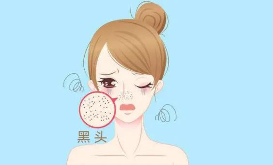 去黑头的正确方法，怎样正确清理黑头（正确使用甲硝唑凝胶和壬二酸去黑头）