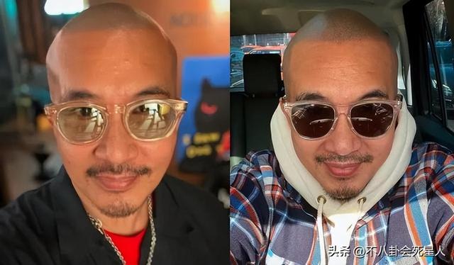 杨幂的发际线是什么样的，14位明星增发妙招