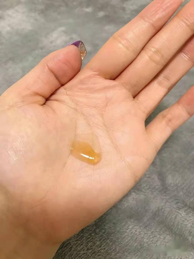 红腰子精华适合什么皮肤，红腰子适合干皮还是油皮（干皮不适合红腰子）