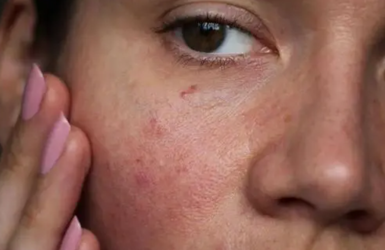 皮肤暗沉的"3个"原因,很多人都没搞清楚