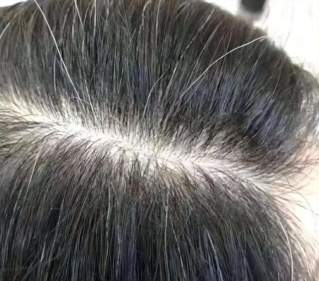人的头发有各种各样的颜色是什么原因造成的，人的头发的颜色是由什么决定的（导致白发的原因有哪些呢）
