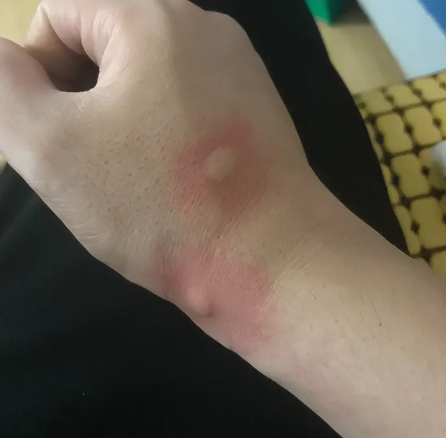 花蚊子，个头不大毒性强（花蚊子怎么消灭掉）