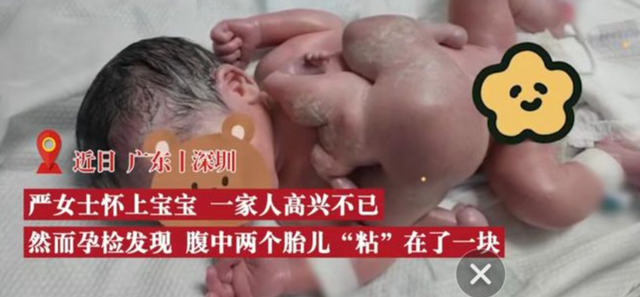 生孩子是从哪个部位生出来的，宫外孕的概率有多大（注定被“割”下的寄生胎）