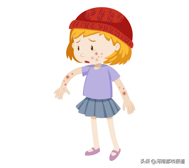 皮肤过敏红疹怎么办，皮肤过敏出现红疹怎么办（脸颊红肿呼吸困难……阳后）