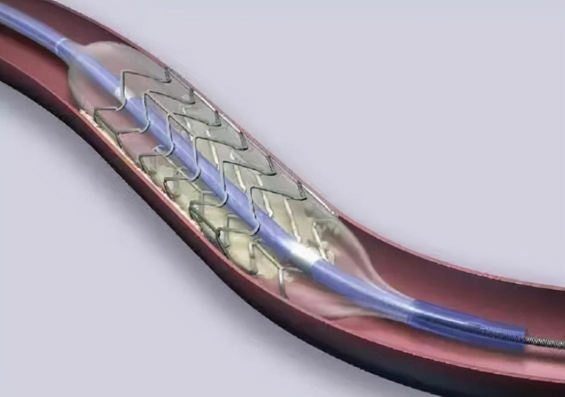 小孩做核磁共振对大脑有没有伤害，儿童做磁共振是否对大脑有影响（为何不建议大家做“核磁共振”）