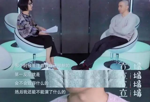 俞灏明毁容前和毁容后，再到摘掉“糊咖”的帽子