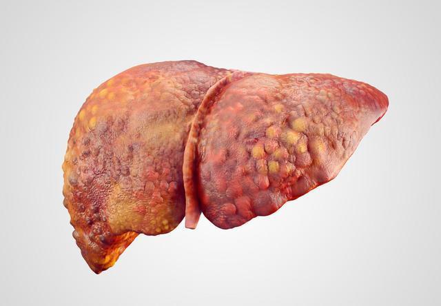 莲藕是发物吗，建议：尽量少吃3物