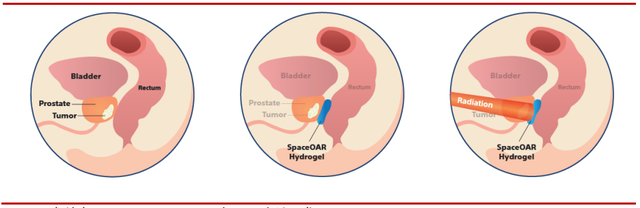生物医用材料主要应用在哪些方面，常见的生物医用材料有哪些（医疗器械领域好帮手）