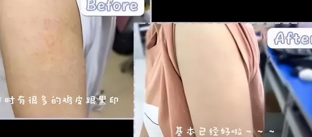 涂身体乳的好处和坏处，涂身体乳和不涂身体乳的区别（每天都涂“身体乳”的人）