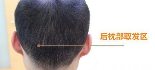 兔唇可以治好吗，兔唇能治好吗（家长的在意点尤其重要）