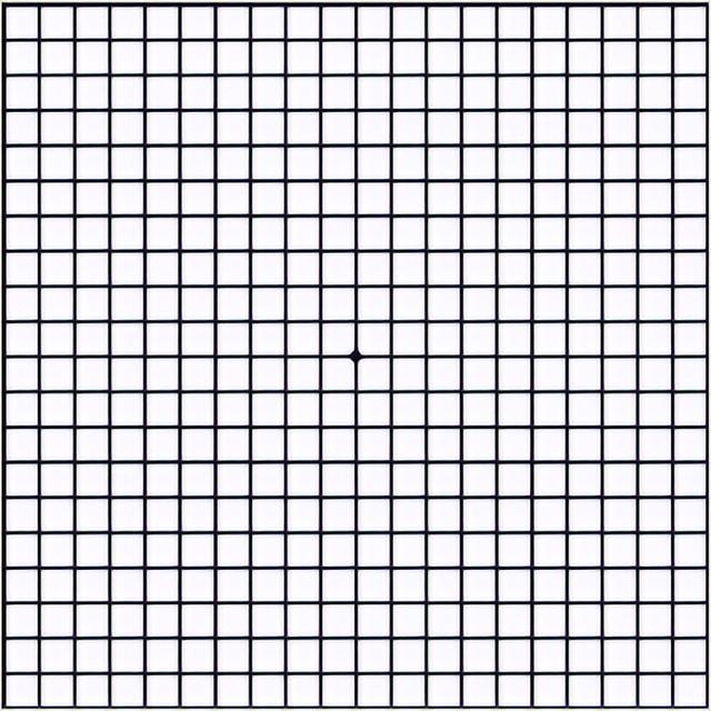 右眼睛跳动是代表什么意思，右眼跳是什么兆头（或是癌症或疾病的预警）