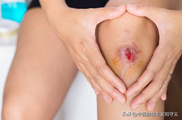 三七和田七的区别图片，田七和三七有什么区别（每日一味抗癌中药——三七）