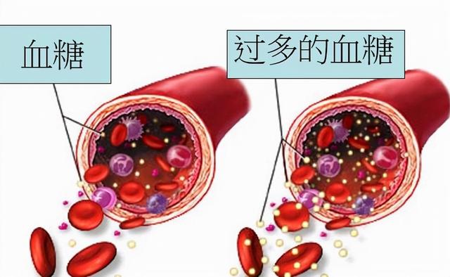 血糖血糖低是多少正常,低血糖多少是正常的(血糖的标准不再是"3.9-6.