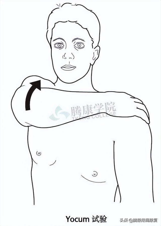 biceph，肩关节的特殊检查（bicep curl）