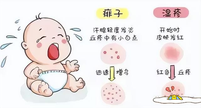 痱子和湿疹的图片对比，湿疹和痱子的对比照（让你轻松认识痱子和湿疹）