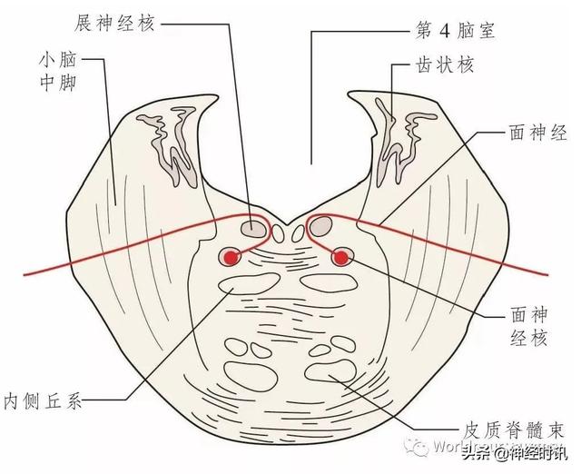 属于膜迷路的结构是，属于膜迷路的结构是蜗管蜗顶（彩图经典版│脑神经和脑神经核解剖）