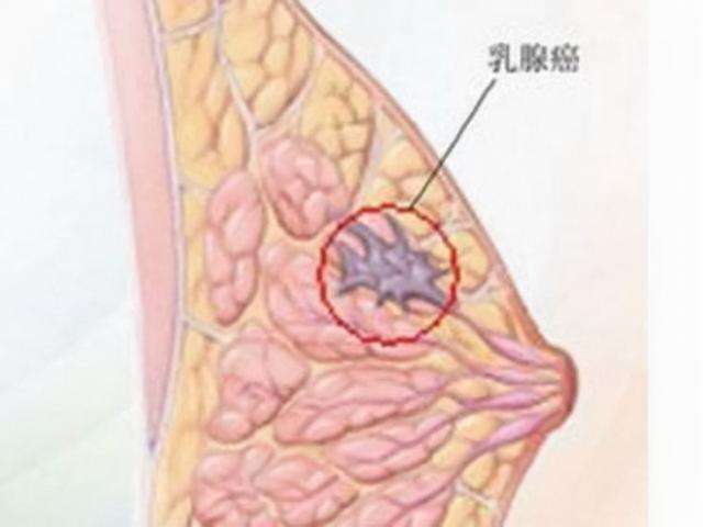 染黑色头发会不会不自然，头发染完自然黑色就染不上其他色了吗（尽量做好以下这3点）