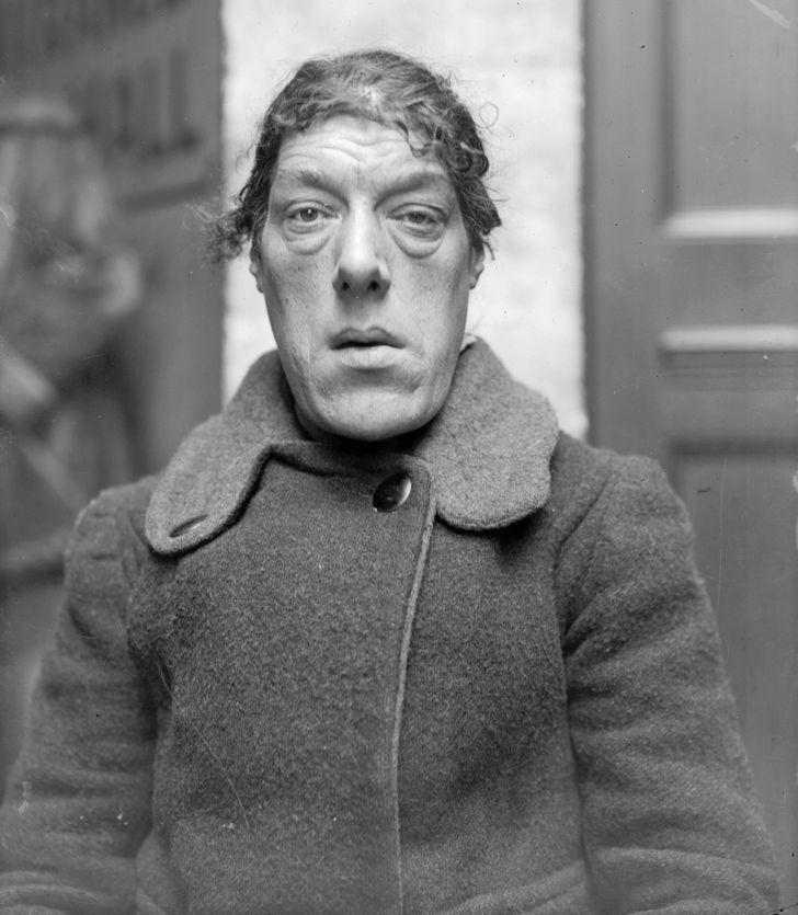 世界上最丑的人(盘点称为"世界上最丑的女人"背后的故事)