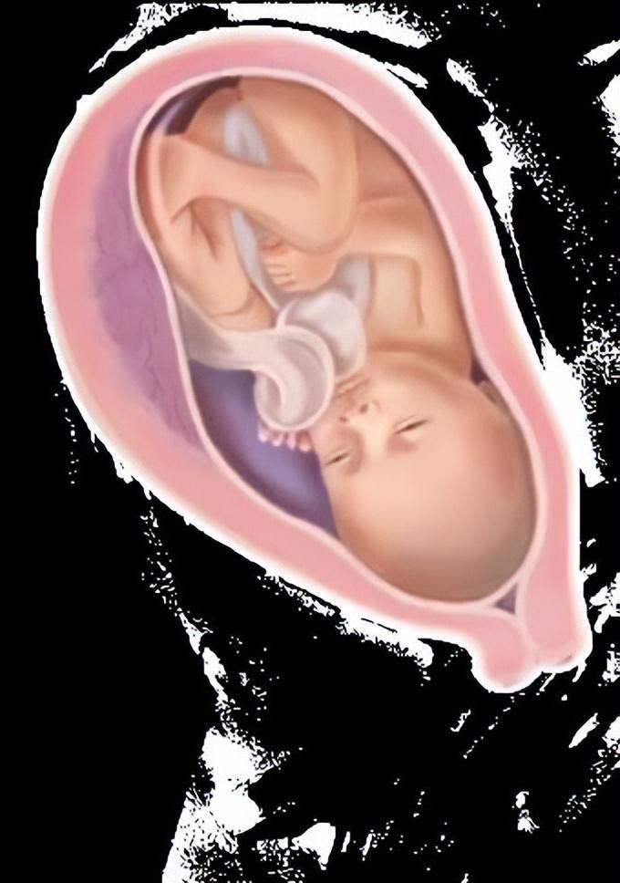 十三周胎儿图片