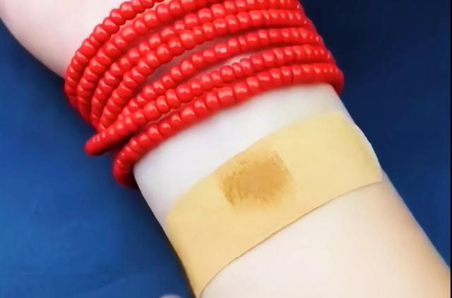 手指扎刺了怎么弄出来，手指被扎刺后如何才能清除（分享14个生活小妙招）