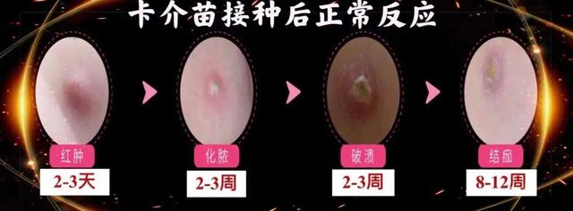 卡介苗的接种时间和意义是什么，卡介苗接种的主要作用是什么?(6分)（宝宝出生后为什么要接种乙肝疫苗和卡介苗）