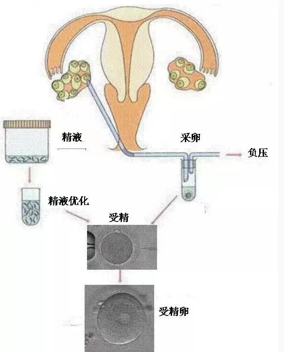 受孕过程是怎么样的，受孕的过程是什么感觉（原来，受精生理过程是这样的）