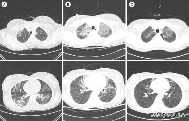 聚六亚甲基双胍，聚六亚甲基双胍的危害是什么（消毒剂放入加湿器中）