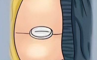 开塞露一次用多少，宝宝用开塞露一次多少（开塞露正确的功效、用法在这里）