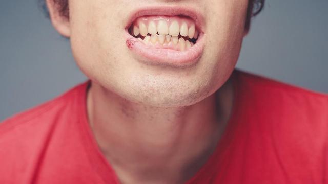 嘴巴上火起泡怎么办，嘴巴起泡怎么办（你以为的“上火”）