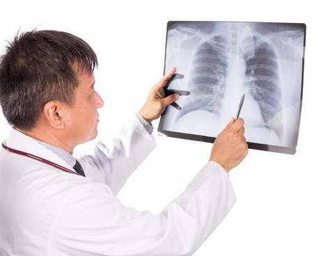 哮喘不能吃什么，哮喘病忌口什么食物（哮喘的日常管理和饮食应该注意些什么）