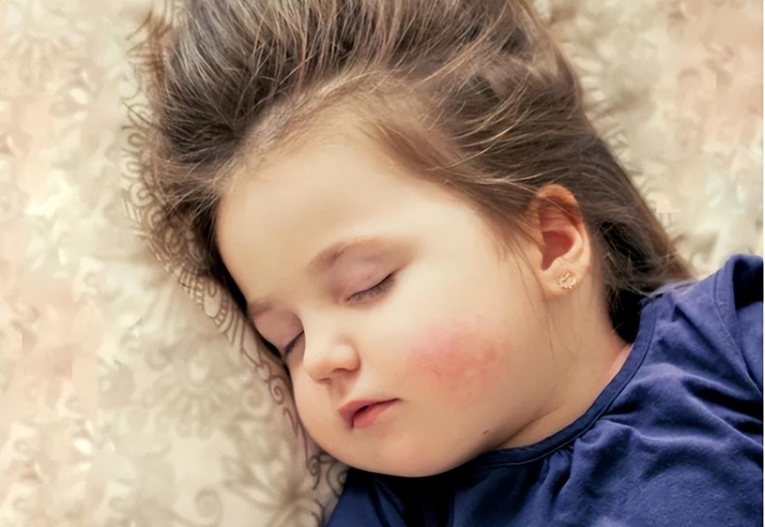 小孩皮肤瘙痒特别晚上怎么办,孩子身上痒痒晚上严重怎么办(宝宝身上老