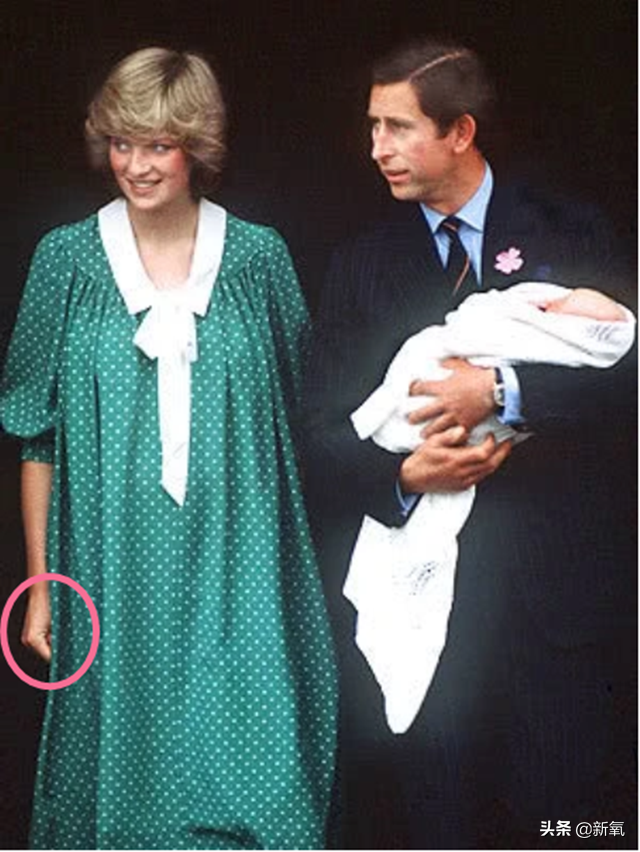 徒手缩阴效果怎样，生育会给女性的身体带来哪些改变